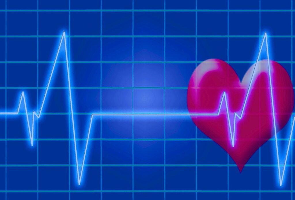Do I always feel Atrial Fibrillation?